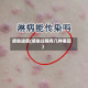 感染进度(感染过程有几种表现)