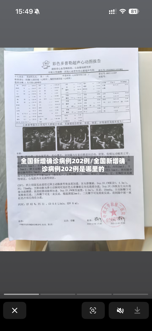 全国新增确诊病例202例/全国新增确诊病例202例是哪里的-第1张图片