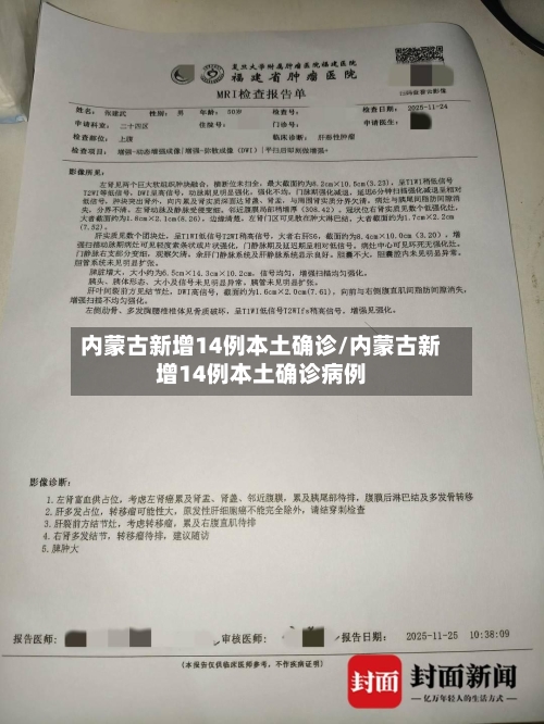 内蒙古新增14例本土确诊/内蒙古新增14例本土确诊病例-第3张图片